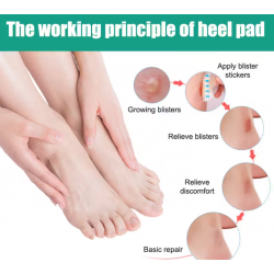 Mbrojtese per Kembet me Xhel | Set 20Cope