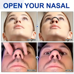 Pajisje me Magnet Kunder Gerhitjes | Nasal Expander