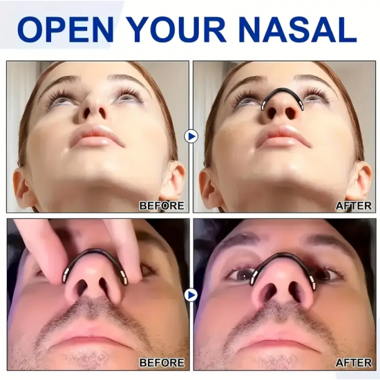 Pajisje me Magnet Kunder Gerhitjes | Nasal Expander